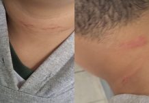 Criança de 10 anos é agredida após quebrar vidro de carro no Limeira, em Brusque Criança é agredida