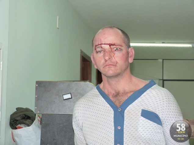 Sandro Kammer, 30 anos, foi preso sob a acusação de agredir o vilante Arlindo Zunino e assaltar o Terminal Urbano de Brusque