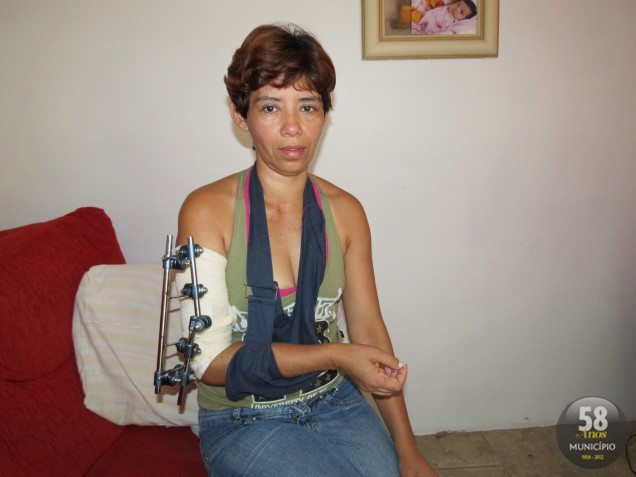 Dionicia Ortiz, 40 anos, ainda se recupera dos tiros que levou do ex-marido, Apolinário Lezcano